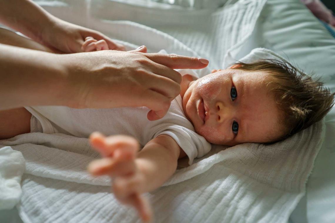 Bildnachweis: © stock.adobe.com / Miljan Živković Baby mit Neurodermitis wird von der Mutter im Gesicht eingecremt